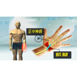 新聞三 | 長期重覆動作易發炎 或致腕管綜合症